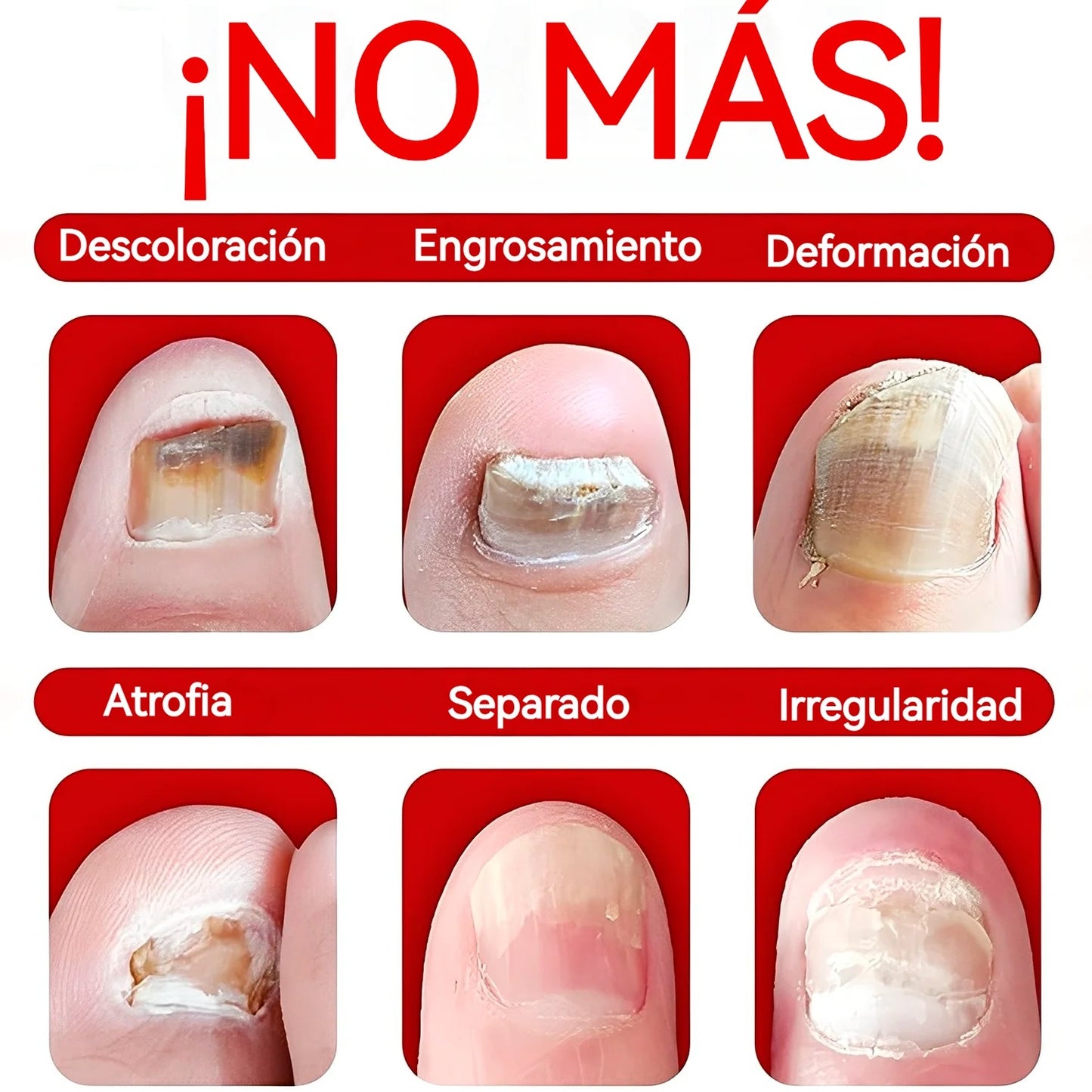 Serum Uñas Fuertes, Claras y Saludables en 7 Días✨💅