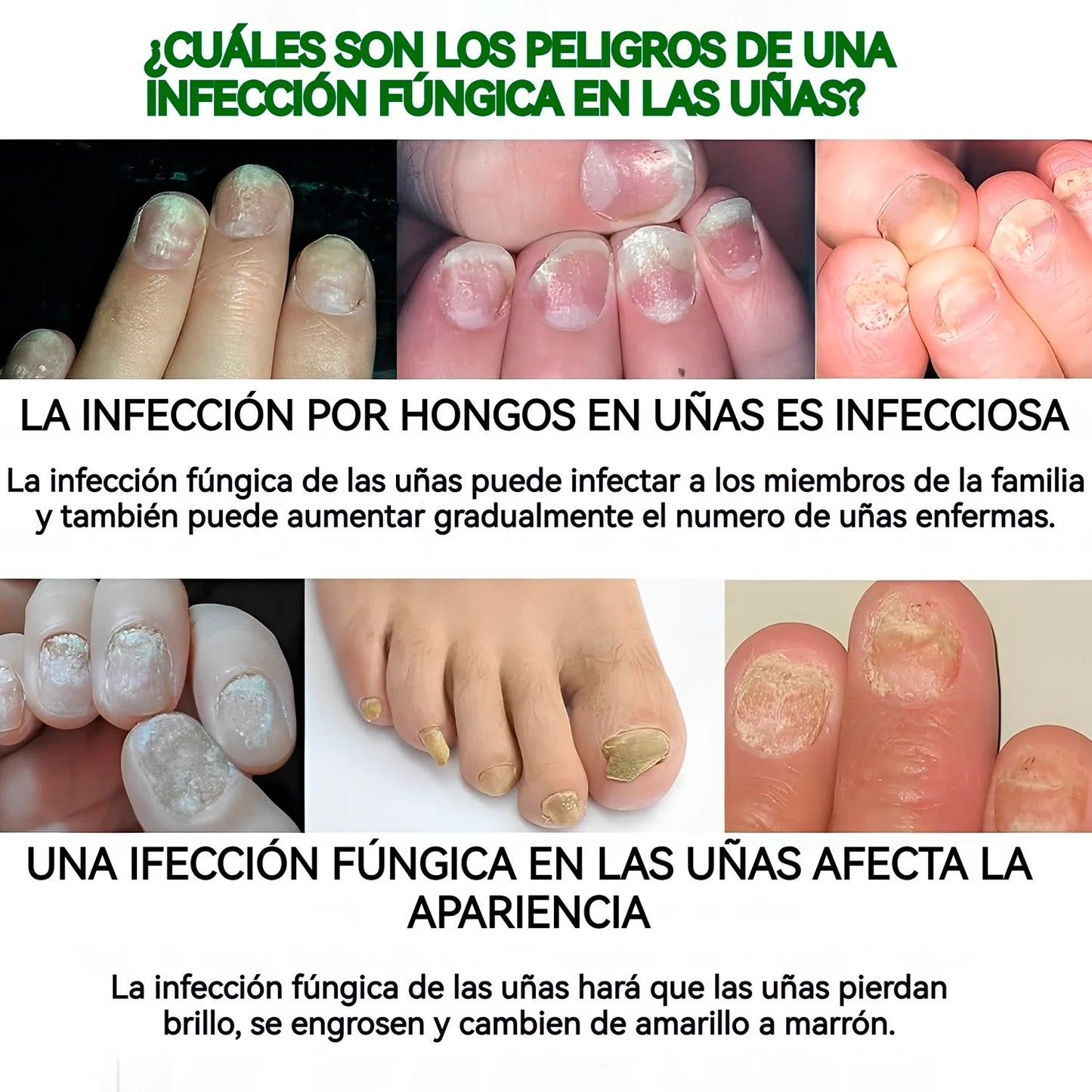 Serum Uñas Fuertes, Claras y Saludables en 7 Días✨💅