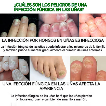 Serum Uñas Fuertes, Claras y Saludables en 7 Días✨💅