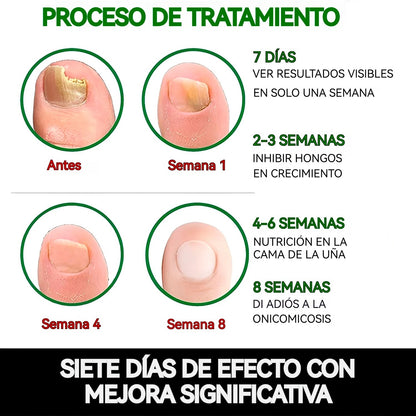 Serum Uñas Fuertes, Claras y Saludables en 7 Días✨💅