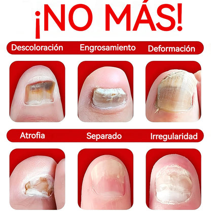 Serum Uñas Fuertes, Claras y Saludables en 7 Días✨💅